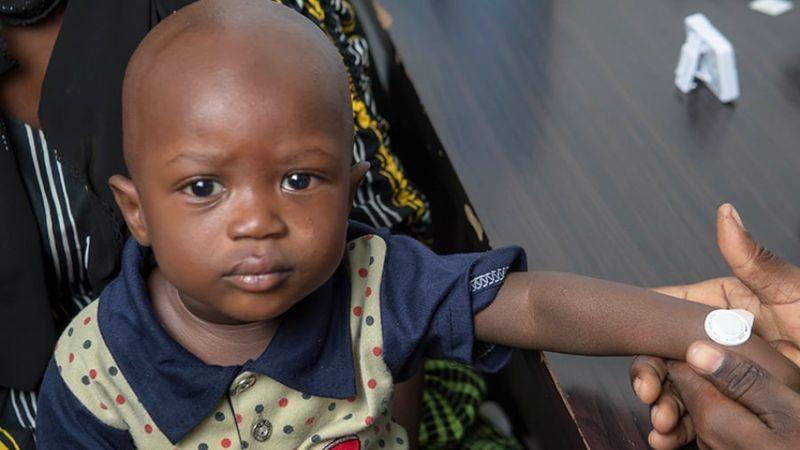 Gambia’da yürütülen mikro iğneli bant aşı testinin sonuçları başarılı
