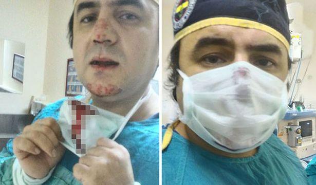 Eşine doğum yaptıracak doktorun burnunu kırdı, o doktor kırık burunla yine de doğuma girdi