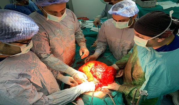 'Karın şişkinliği' sanıyordu, 11 kilo kitle çıktı