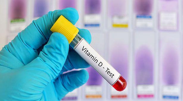 'D vitamini eksikliği gibi D vitamini fazlalığı da insan sağlığına zararlı'