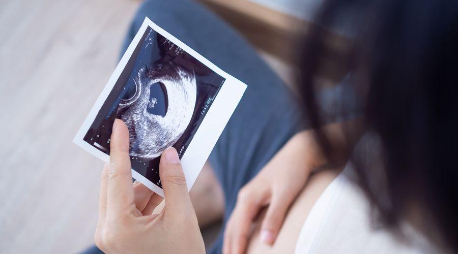 Araştırma: D﻿üşükten hemen sonra hamile kalmak sanıldığı gibi riskli olmayabilir