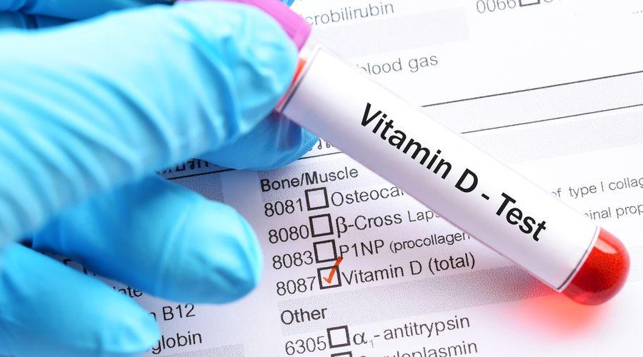 Çalışma, çocuklarda D vitamini testlerinin aşırı kullanımını ortaya koydu