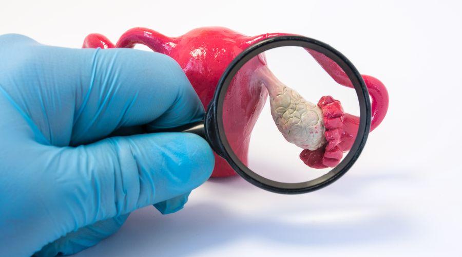 Gençken yumurtalığın alınması Parkinson riskini artırabilir