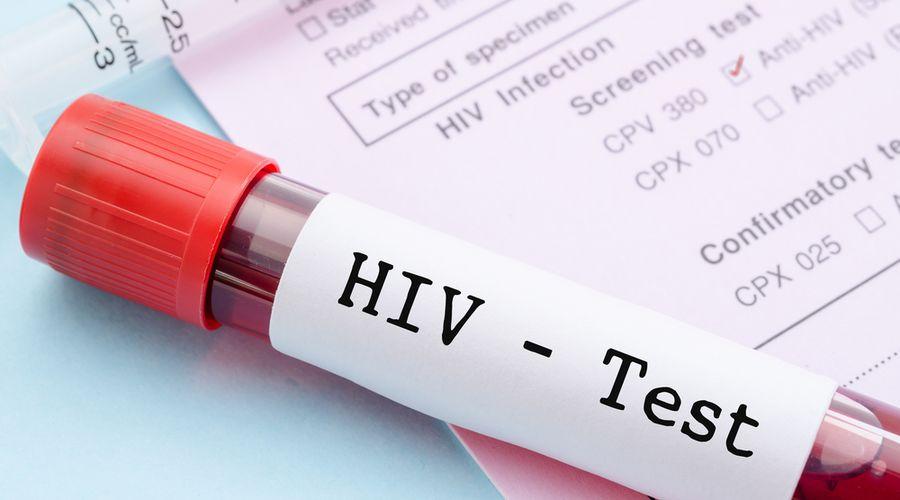 HIV tedavisinde yeni bir yöntem geliştirildi