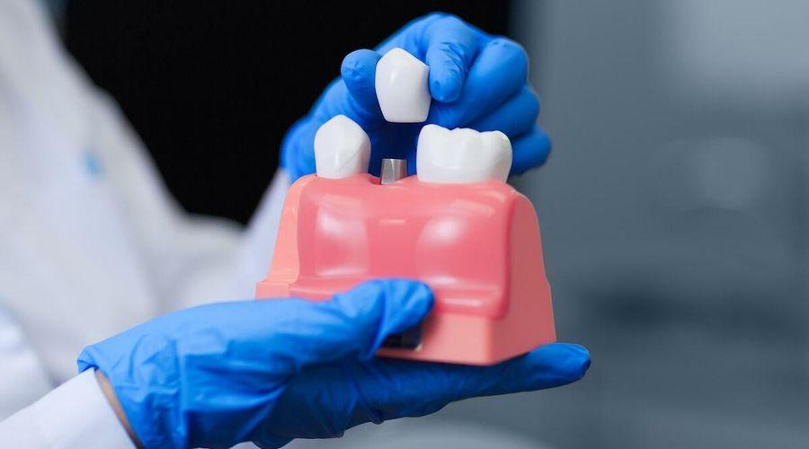 Dental implant tedavisi hakkında bilinmesi gerekenler