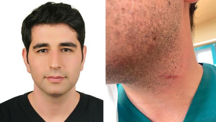 Hasta yakını, 'adli vaka' girişi yapan doktoru darbetti