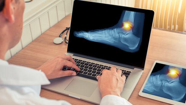 Obezite kemik kırığı riskini artırıyor