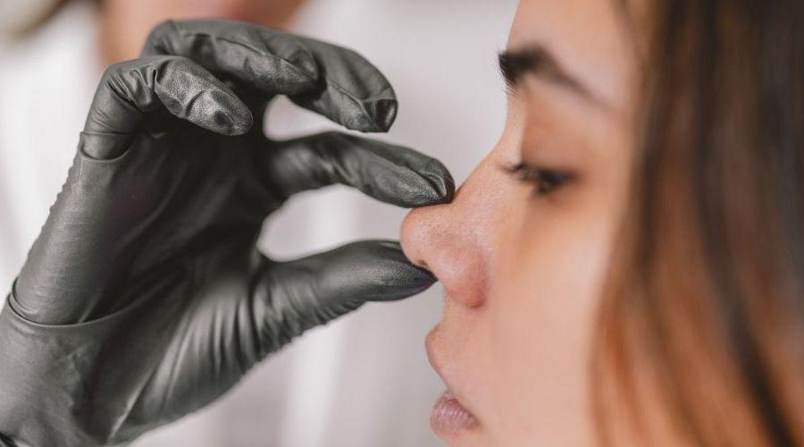 Burun estetiği sonrası doktor önerileri