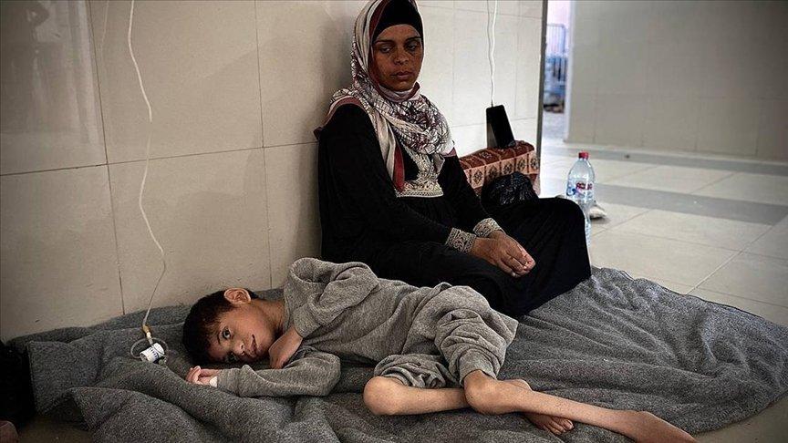 Filistinli doktor el-Hur: Hastaneler yetersiz beslenme vakalarıyla dolu