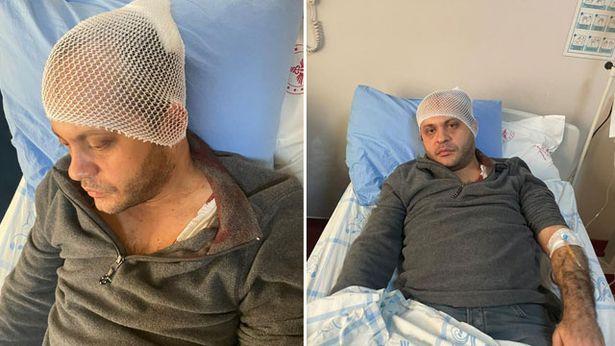 Randevu vermediğini iddia etti: Mermer parçasıyla doktorun kafasına defalarca vurdu