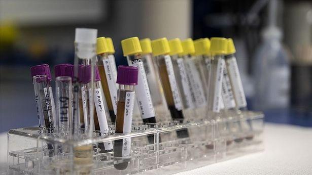 DSÖ duyurdu: Gizemli hepatit virüsünden ilk ölüm