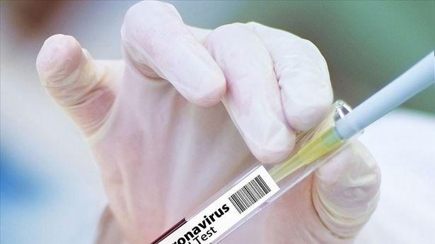 Uzun COVID yaşama riskiniz ne kadar? Bilim insanları erken tanı için formül geliştirdi