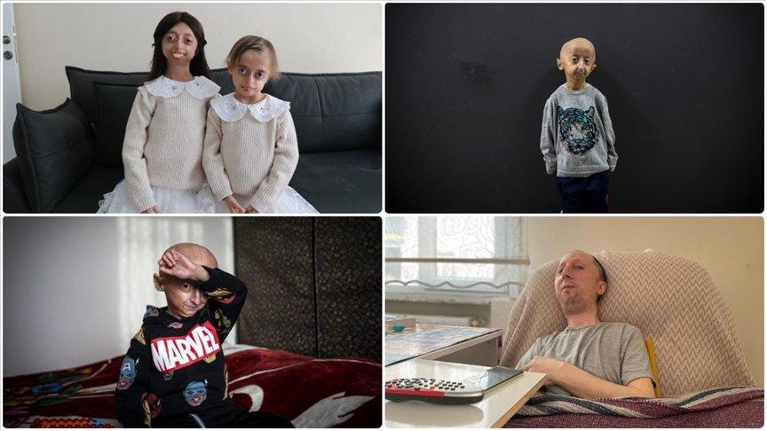 Dünya genelinde 400 milyona yakın insan nadir hastalıklarla mücadele ediyor