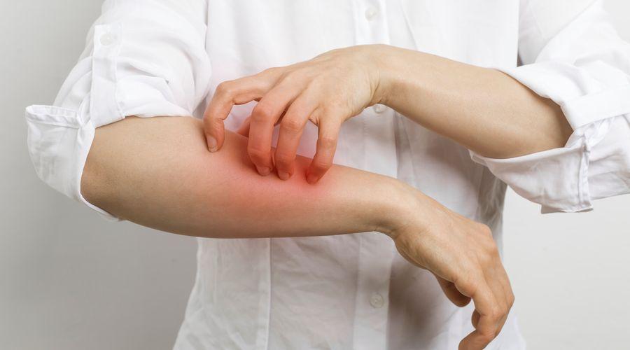 Kliniklerdeki uyuz vakaları yüzde 25’e yükseldi