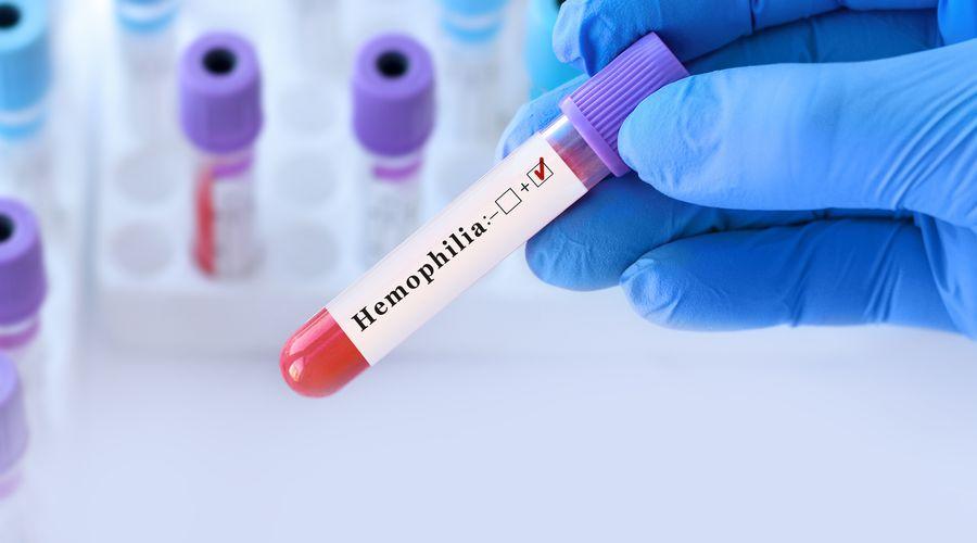 Hemofili A hastalarına deri altı uygulanabilen ilaç geri ödeme kapsamına alındı