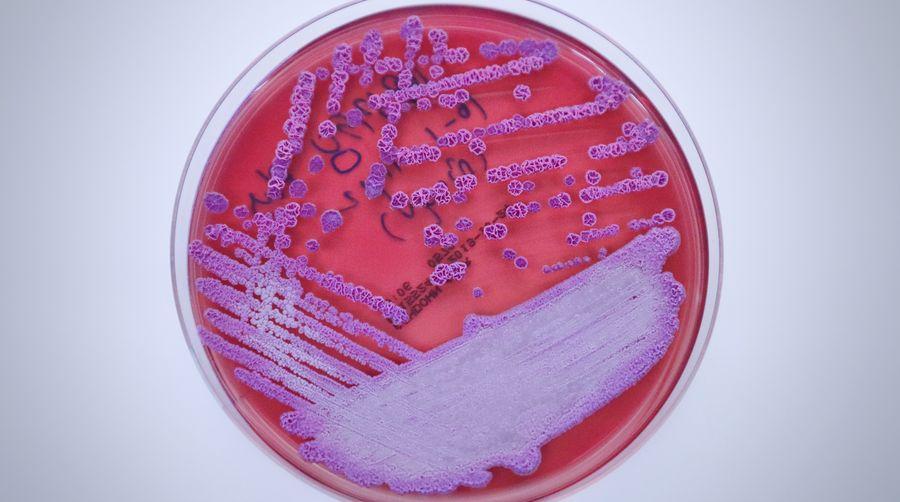 Avustralya'da melioidoz salgını! Can kaybı 31'e çıktı