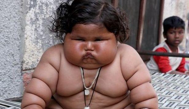 Sürekli yemek yiyor, 8 aylık bebek 17 kiloya ulaştı!