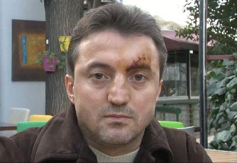 Bu kez doktor, hasta yakınını darp etti!