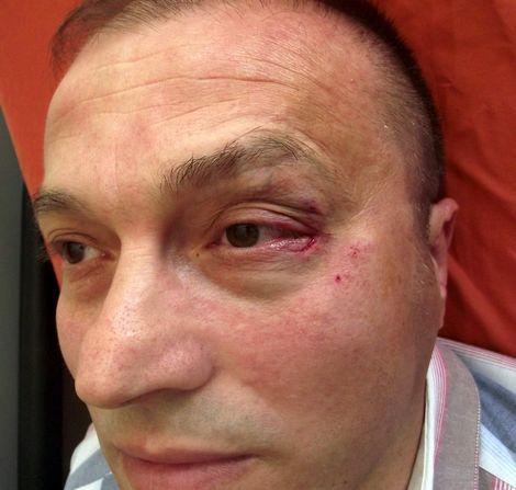 Doktoru darpeden saldırgan, başsavcılığın itirazı ile tutuklandı