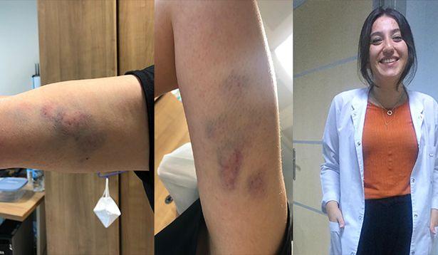 Covid-19 hastası, 'bana yaklaşma' diyen kadın doktora saldırdı