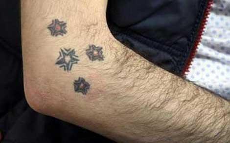 Radyoloji uzmanı 'dövmeli' gence MR çekmeyi riskli gördü