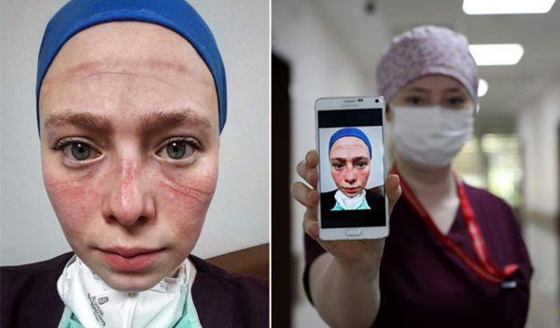 Yoğun bakım çalışma zorluğu yüzüne yansıyan Seher hemşireye övgü