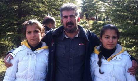 İkizleri ayıran sır ölüme ihmal iddiasıyla soruşturma