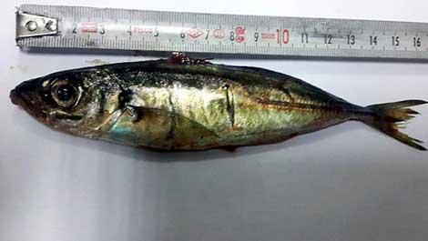 Hasta istavrit yuttu, 16 cm'lik balığı anestezi uzmanı elleriyle çıkardı
