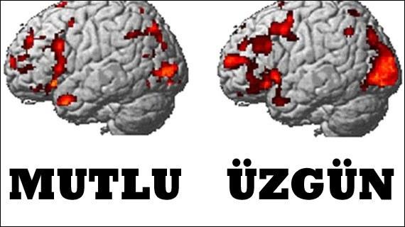 Duyguların beyin MR'ı çekildi
