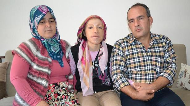 14 yaşına kadar 38 ameliyat geçirdi