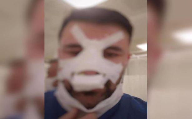 ATT'yi bu hale getirmişti, ifadesi şaşırttı: O bana yumruk attı!