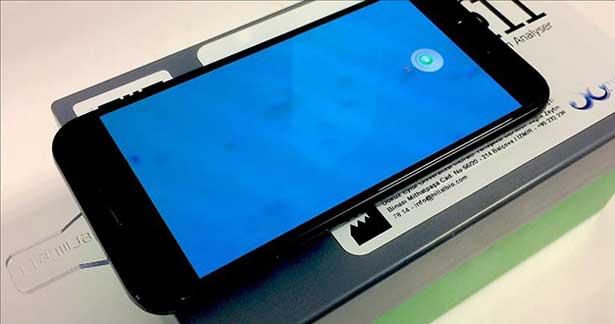Cep telefonu uygulamasıyla en iyi sperm tespiti: Spermcell