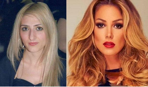 'Petek Dinçöz'ün burnundan istedi, olmayınca 200 bin liralık tazminat davası açtı!