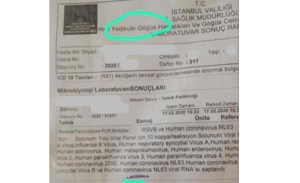 Bakan Koca'dan İstanbul'daki koronavirüs  iddialarına açıklama: Kovid-19 değil, NL63
