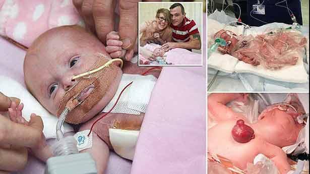 Doktorları bile şaşırttı: Onun adı mucize!