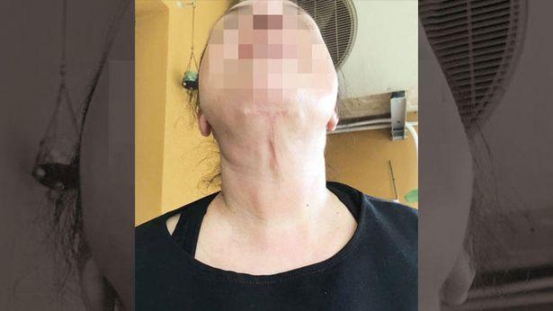 Estetik ameliyat sonrası doktor ve hastaneye dava: 305 bin TL tazminat 