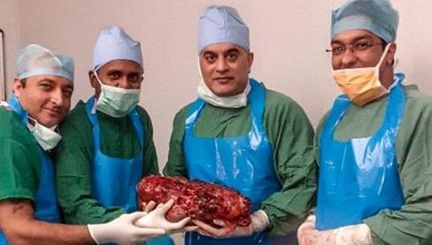 Tıp literatürüne göre en ağır 3. böbrek ameliyat ile alındı: 7,4 kilogram