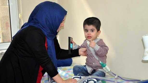 Jeune sendromlu çocuğun göğüs kafesi genişletilerek, rahat nefes alması sağlandı