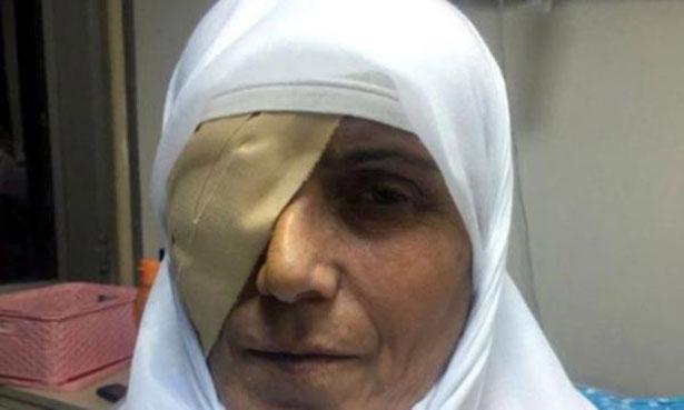 Katarakt ameliyatından sonra kör olan hasta, Sağlık Bakanlığına 570 bin liralık tazminat davası açtı