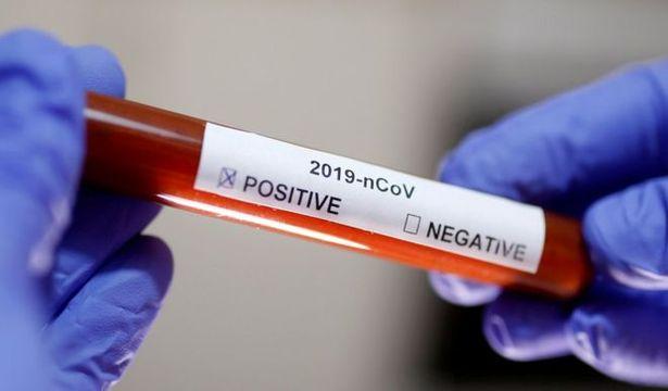 İngiltere'de yanlışlıkla 43 bin kişiye Kovid-19 testlerinin negatif olduğu söylendi
