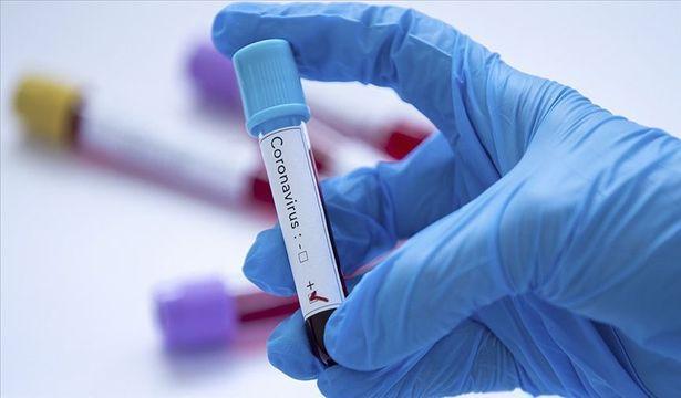 Dünya genelinde Kovid-19 tespit edilen kişi sayısı 18 milyon 261 bini geçti
