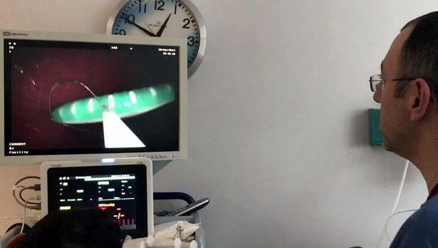 Kusmak için diş fırçası kullanan kadın fırçayı yuttu...2 gün sonra taburcu edildi