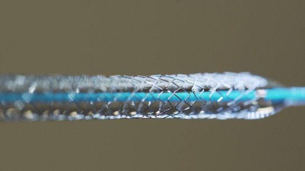 Koroner kalp hastalıkları için mikron düzeyde stent geliştirildi 