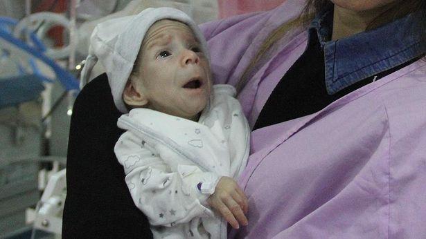 28 haftalık mucize bebek 5 ameliyat geçirdi: 3 bağırsak ve 2 diz kemiği ameliyatı