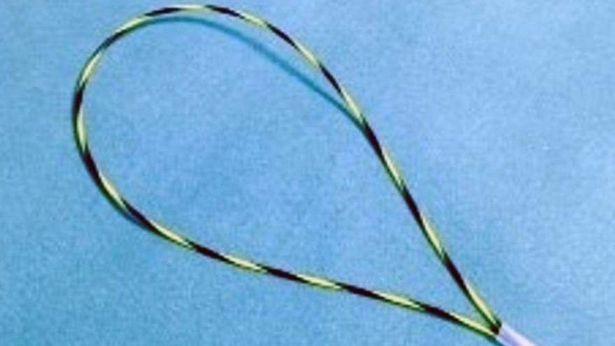 İtalyan doktorları şaşırtan vaka: Hastanın vücudundaki cismi çıkarmak için sistem geliştirdiler
