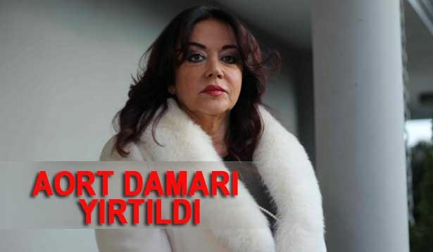  Aort damarı neden yırtılır?
