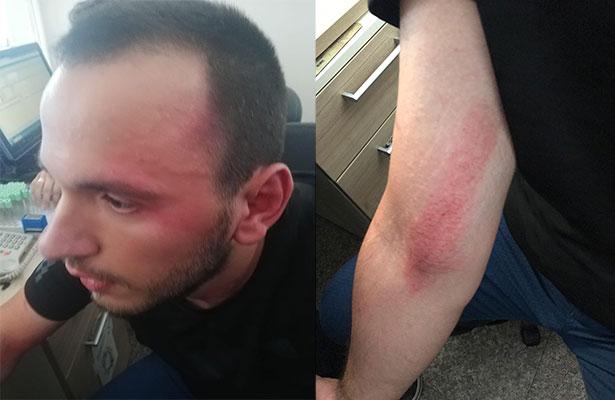 Doktor, 2 özel harekat polisi tarafından acil serviste görevi başında darp edildi!