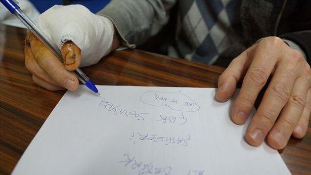 53 yıl sonra elini kullanmaya başladı: 'Normal bir ele yakın işlev görecek'