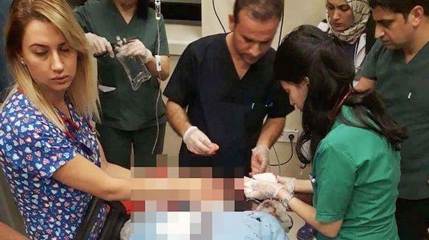 Kadın doktora beyzbol sopası ile darp: 'İşimi elimle yapıyorum sadece buraya saldırdılar'