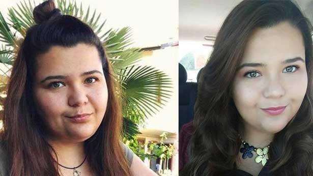 Üniversite hastanesi, obezite ameliyatından ölen avukat için soruşturma başlattı